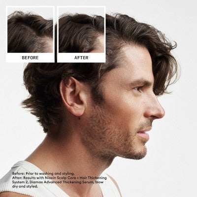 Nioxin System 2 Hair Thickening Natural & Untreated Hair Shampoo & Conditioner Kit 3ct - New